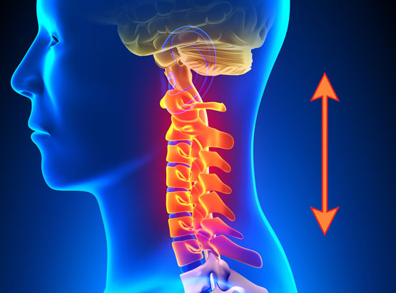 Décompression cervicale